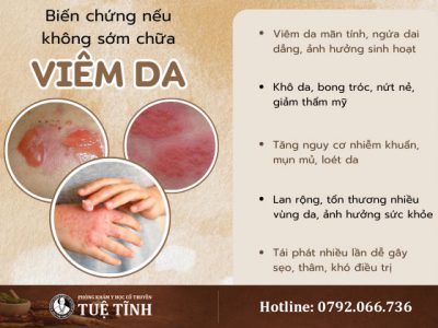 bien-chung-viem-da-2