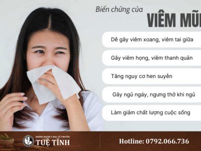 bien-chung-viem-mui-3