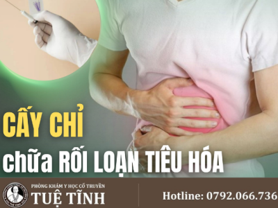cấy chỉ (4)