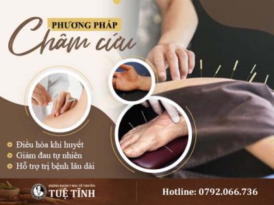 cham-cuu-dieu-hoa-khi-huyet-giam-dau-tu-nhien-ho-tro-tri-benh-lau-dai