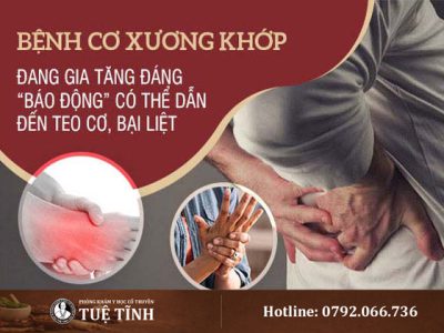 dau-la-benh-vien-co-xuong-khop-uy-tin-hien-nay-tai-tphcm-6810-1
