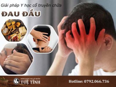dieu-tri-benh-dau-dau-bang-phuong-phap-dong-y-an-toan-tin-cay-6881-1