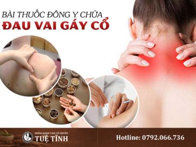 dieu-tri-dau-co-vai-gay-yhct
