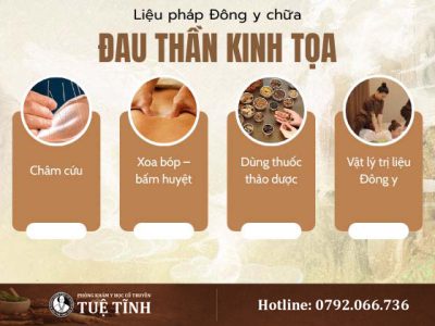 dieu-tri-dau-than-kinh-toa