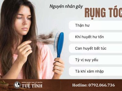 dieu-tri-rung-toc-theo-dong-y-voi-lieu-phap-lanh-tinh-ngan-ngua-gay-rung-va-bao-ve-toc-chac-khoe-4374-1