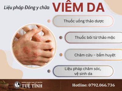 dieu-tri-viem-da-1