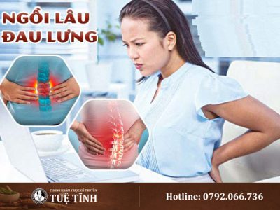 giai-phap-dong-y-cho-nguoi-ngoi-lau-dau-lung-dan-van-phong-nen-biet-de-som-chua-4731-4