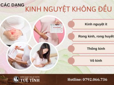 kinh-nguyet-khong-deu-0