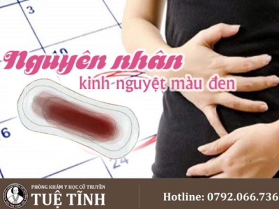 kinh nguyệt