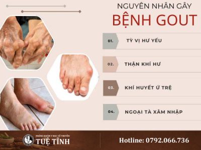 nguyen-nhan-gay-benh-gout