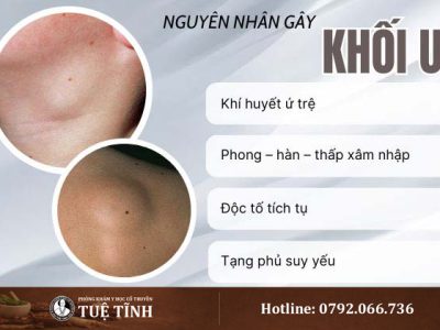 nguyen-nhan-khoi-u