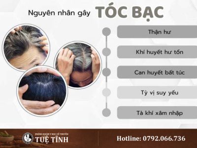 nguyen-nhan-toc-bac