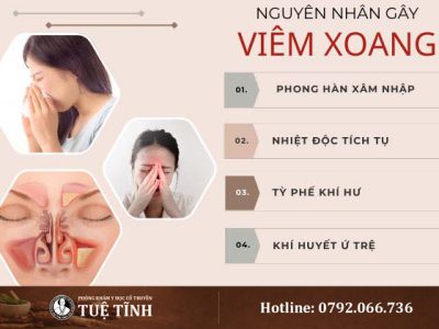 nguyen-nhan-viem-xoang