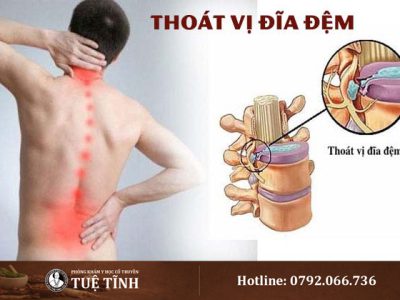 phong-kham-dieu-tri-thoat-vi-dia-dem-gan-day-6478-1