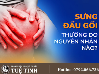 sưng đầu gối