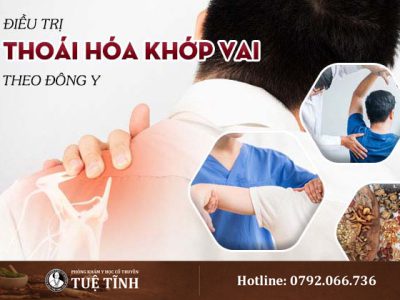 thoai-hoa-khop-vai-01