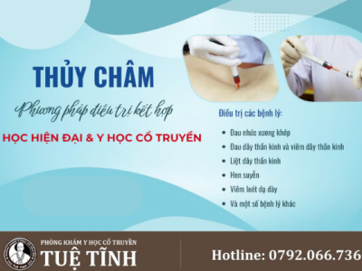 thủy châm