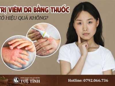 tri-viem-da-bang-thuoc-1