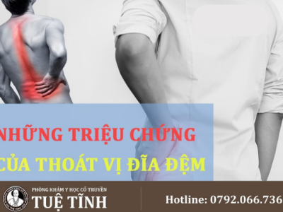 tvdd (1)