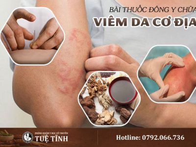 viem-da-co-dia-yhct-2